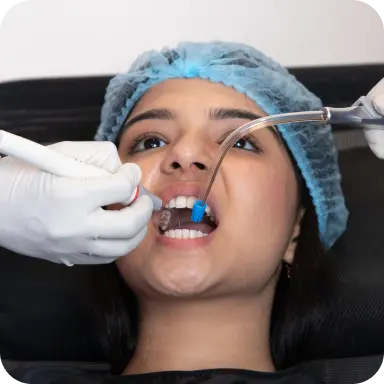 Detailed teeth depositions and stains removal at home